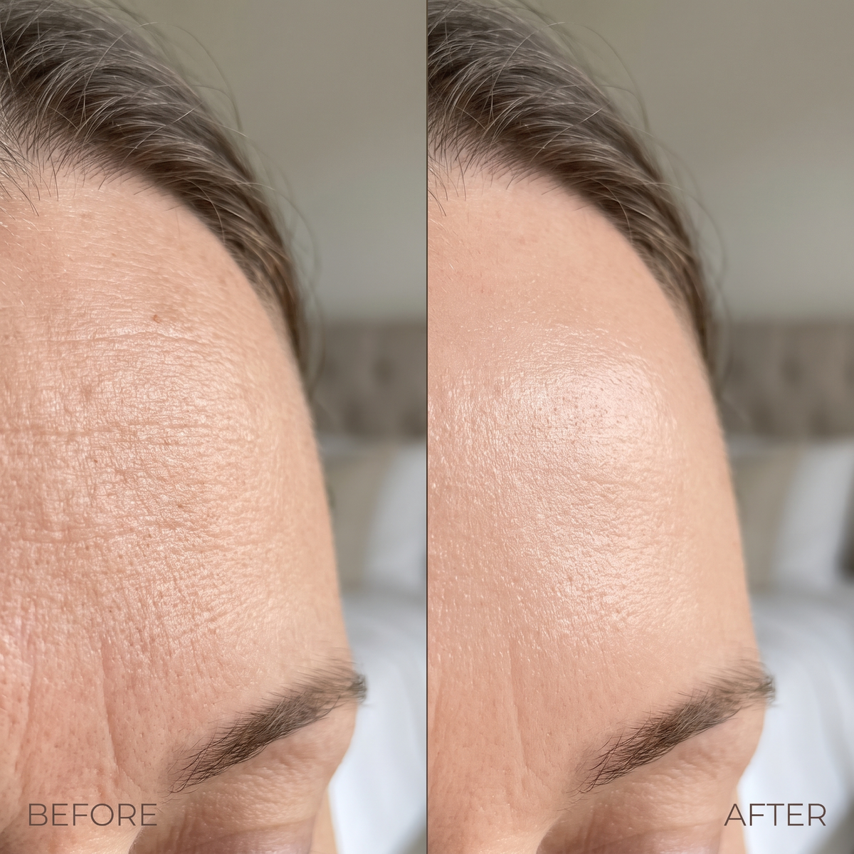 BloomMix EGF Tox — Wrinkles Ironed Out, Naturally