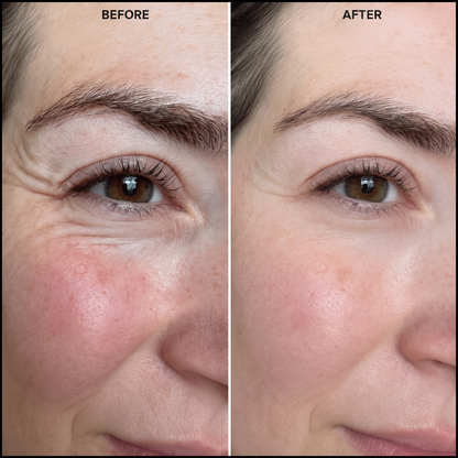 BloomMix EGF Tox — Wrinkles Ironed Out, Naturally