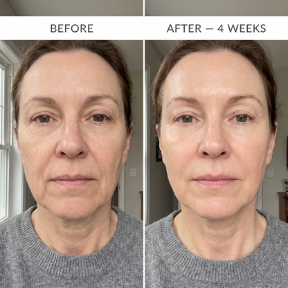 BloomMix EGF Tox — Wrinkles Ironed Out, Naturally