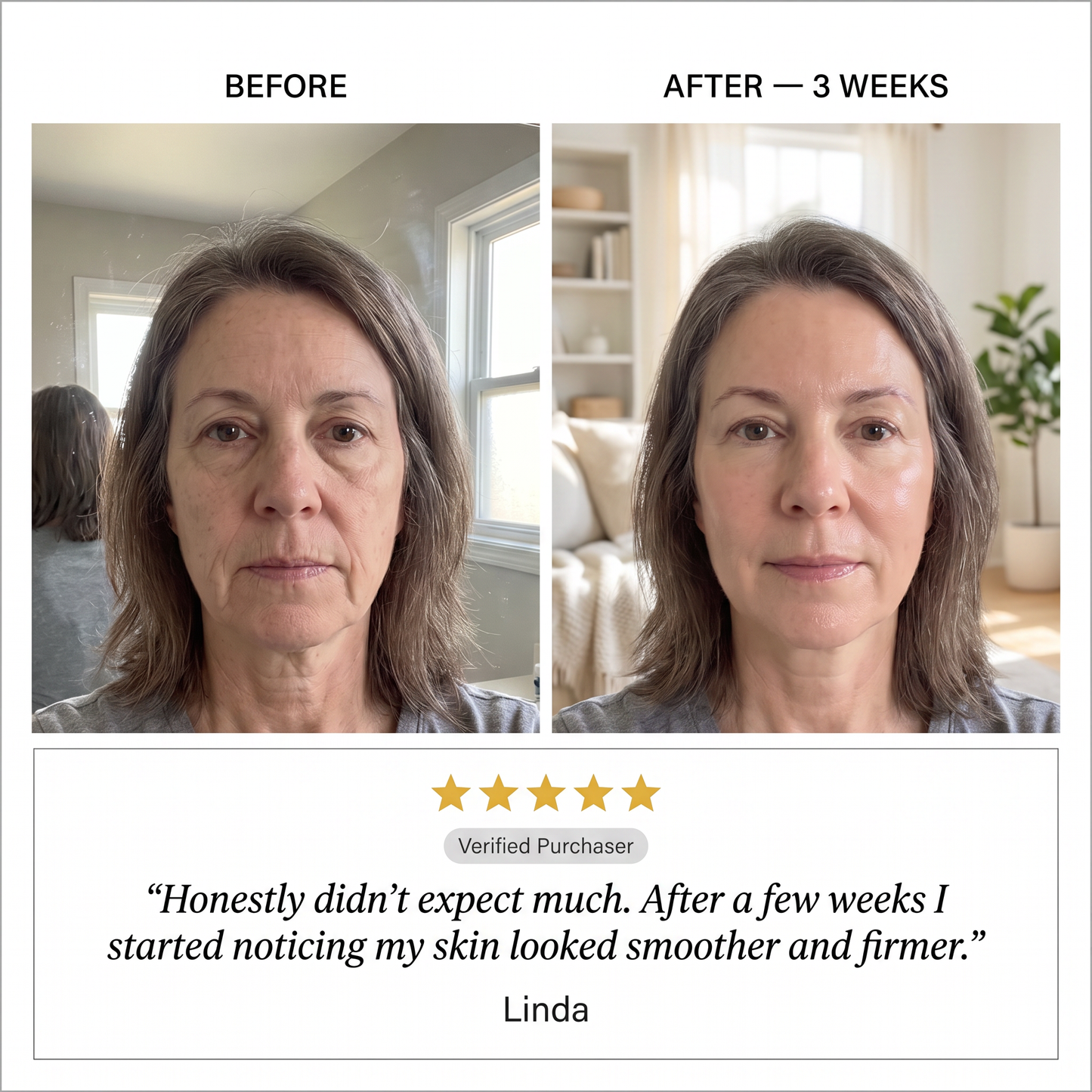 BloomMix EGF Tox — Wrinkles Ironed Out, Naturally