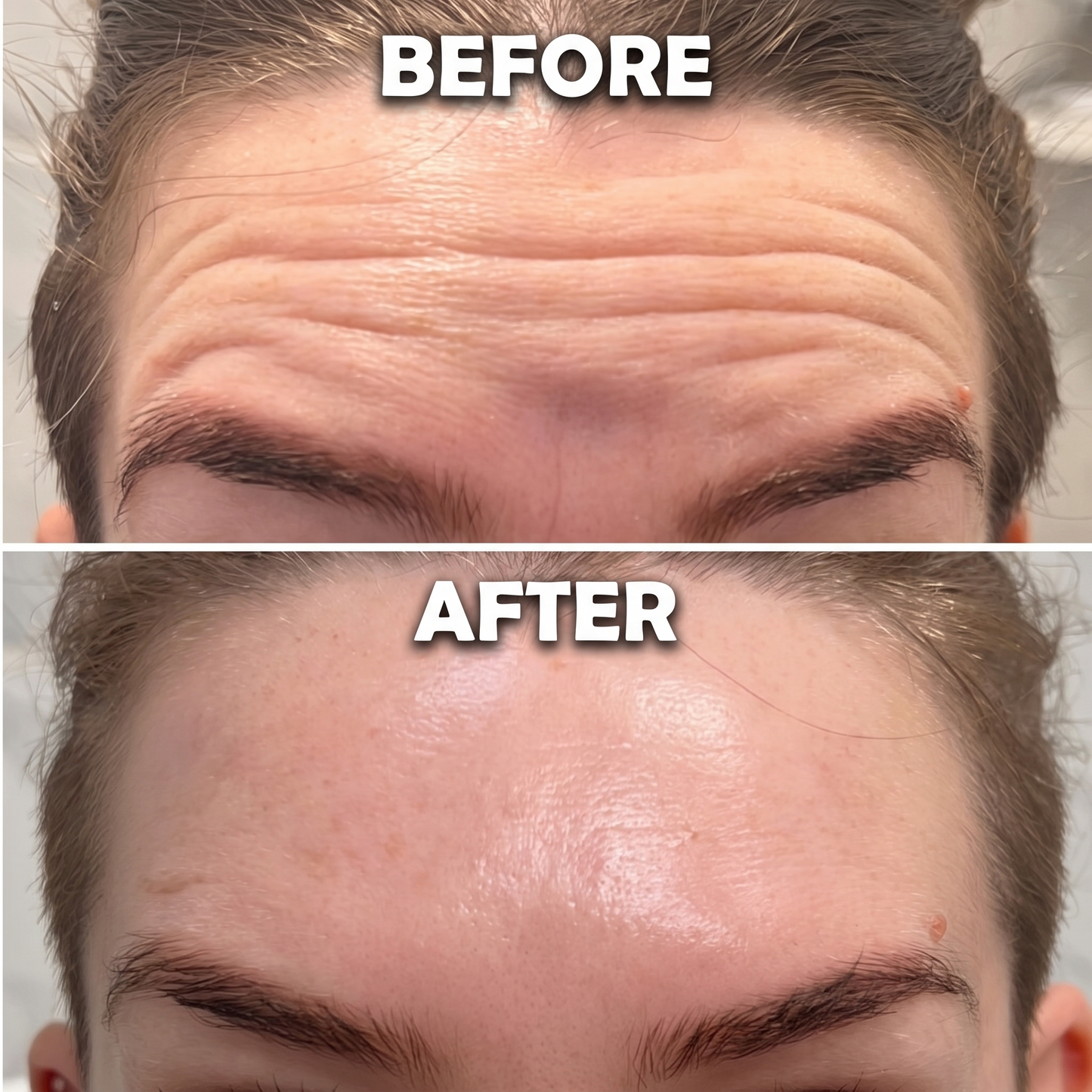 BloomMix EGF Tox — Wrinkles Ironed Out, Naturally